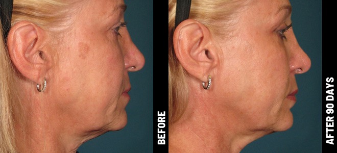 MORE PATIENT RESULTS 