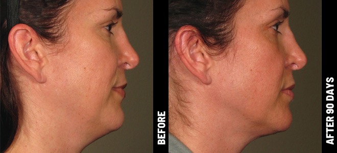 MORE PATIENT RESULTS 