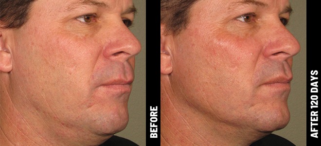 MORE PATIENT RESULTS 