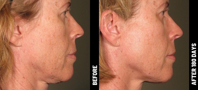 MORE PATIENT RESULTS 