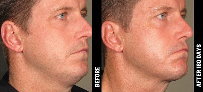 MORE PATIENT RESULTS 