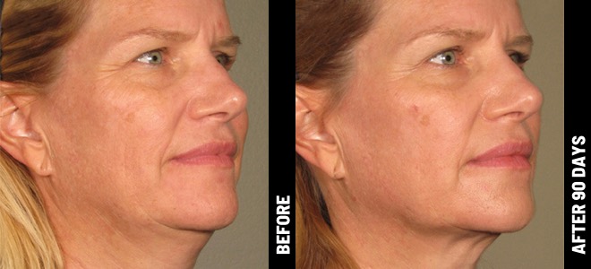 MORE PATIENT RESULTS 