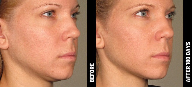 MORE PATIENT RESULTS 